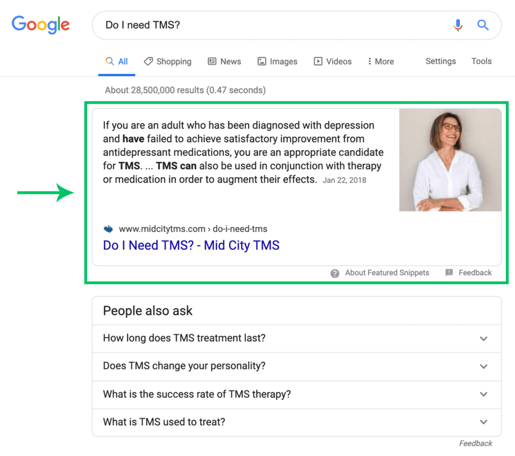 Google search for "Do I need TMS?" which lists a Mid City TMS article first