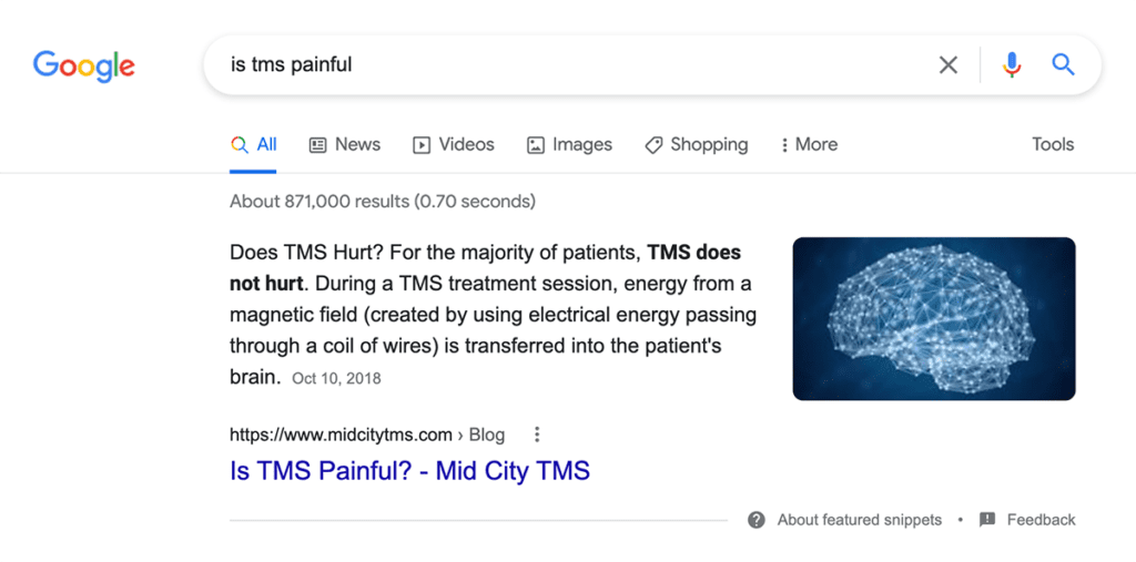 MidCity TMS featured snippet for "is tms painful" search